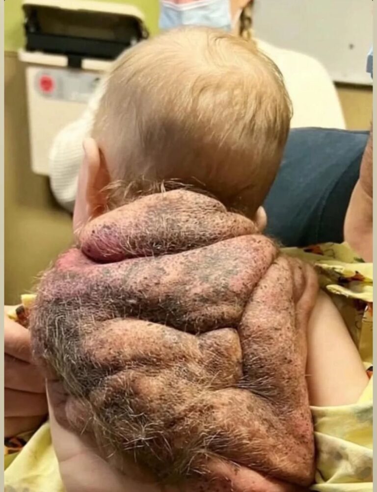 Her Little Superhero Was Born With His Own ‘Ninja Turtle Baby’ Shell